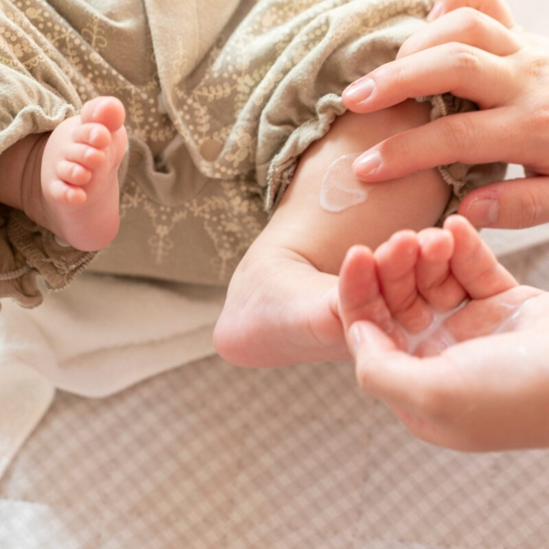 【WEBクリニック】保湿薬を塗っていても体を掻きむしってしまいます。